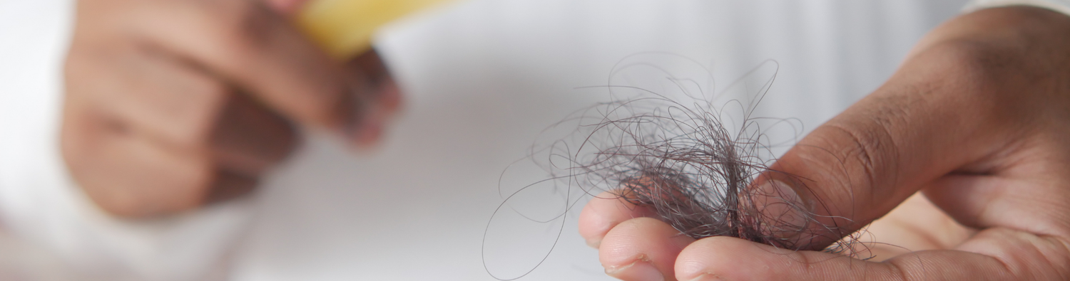 female pattern baldness