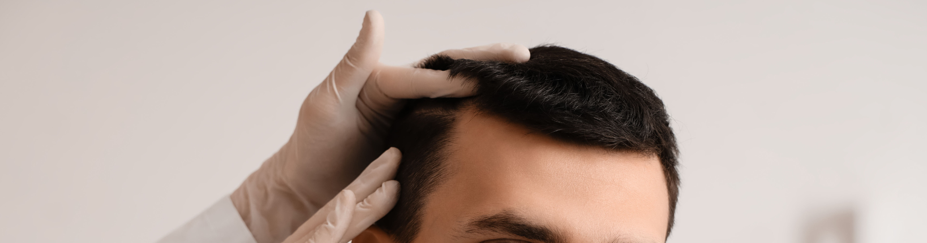 minoxidil alternative