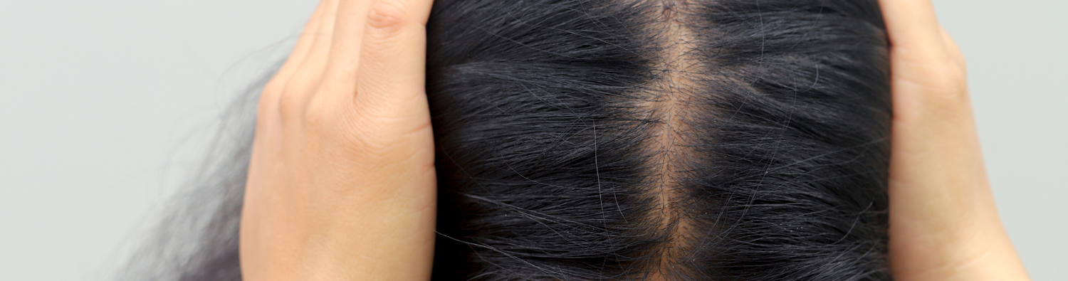 scalp oil