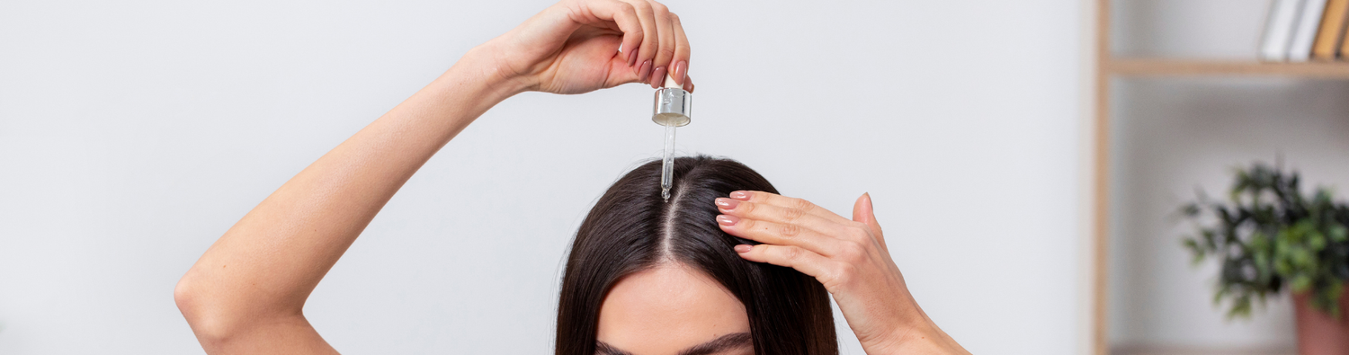 minoxidil alternatives